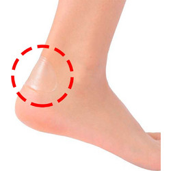 Easy Step Foot Care Eπιθέματα για Φουσκάλες 4τμχ