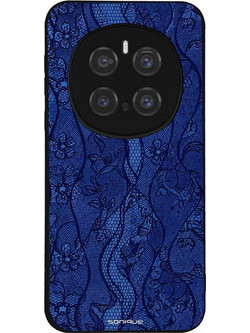 Sonique DIVA Series Θήκη (Honor Magic7 Pro 5G) Μπλε Δαντέλα