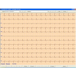 Λογισμικό ΗΚΓ Aspel CardioTEKA